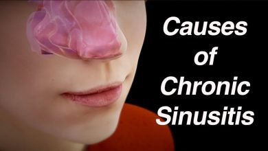 سینوزیت مزمن چیست /درمان فوری سینوزیت مزمن با گیاهان دارویی