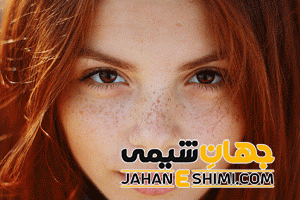 5 دلیل بروز کک و مک در صورت | دارو و درمان کک و مک