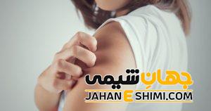 بیماری لوپوس چیست؟ | دارو و درمان لوپوس چیست؟