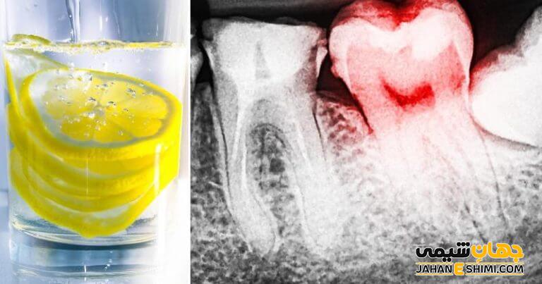 مضر بودن اسید سیتریک برای دندان چگونه است؟
