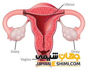 5 دلیل نارسایی تخمدان چیست؟ | دارو و درمان نارسایی تخمدان