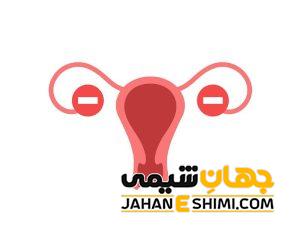 5 دلیل نارسایی تخمدان چیست؟ | دارو و درمان نارسایی تخمدان
