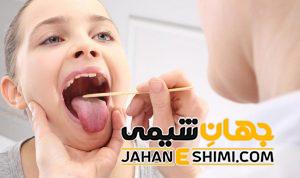 10 دلیل بروز گلودرد چیست؟ | دارو و درمان فوری و خانگی گلودرد