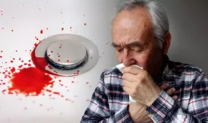 10 دلیل بروز استفراغ خونی و راه های درمان آن