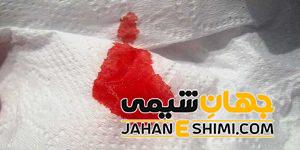 10 دلیل بروز استفراغ خونی و راه های درمان آن