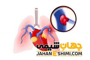 علائم و دلیل آمبولی ریه چیست؟ | دارو و درمان آمبولی ریه