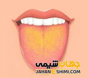 مهم ترین دلایل زرد شدن زبان چیست؟ | دارو و درمان زرد شدن زبان