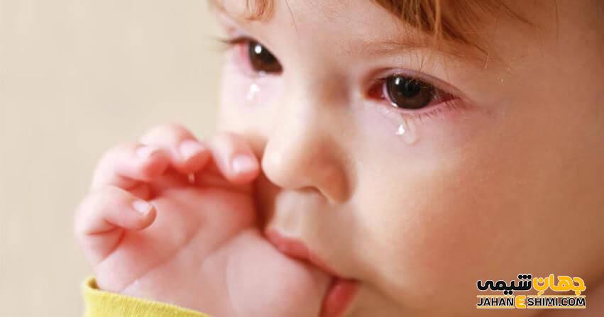 آبریزش چشم کودک در سرماخوردگی