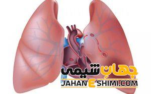 علائم و دلیل آمبولی ریه چیست؟ | دارو و درمان آمبولی ریه