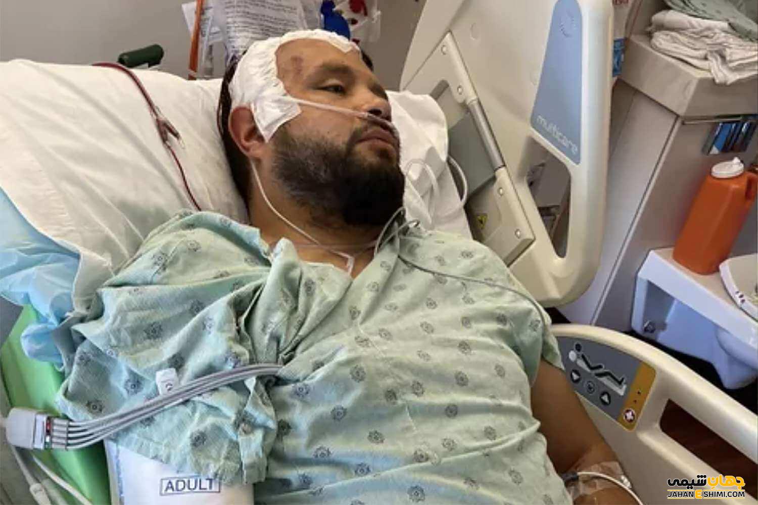 خونریزی مغزی چیست
