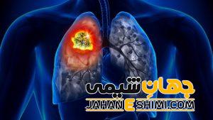 علائم و دلیل آمبولی ریه چیست؟ | دارو و درمان آمبولی ریه