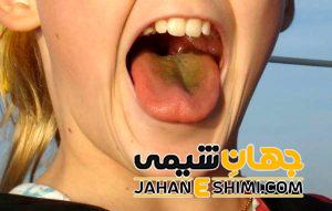 مهم ترین دلایل زرد شدن زبان چیست؟ | دارو و درمان زرد شدن زبان