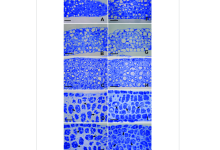کوماسی بریلینت بلو چیست؟ - خواص و مزایا