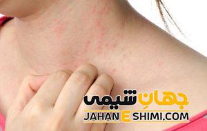 خارش پوست به چه علتی رخ می دهد؟ | 2 درمان شگفت انگیز درمان خارش پوست
