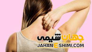 خارش پوست به چه علتی رخ می دهد؟ | 2 درمان شگفت انگیز درمان خارش پوست