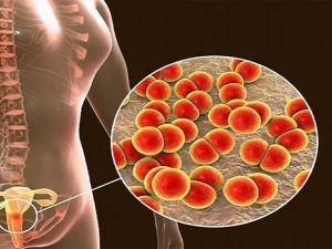 ادرار دردناک به چه دلیلی ایجاد می شود؟ | دارو و درمان ادرار دردناک