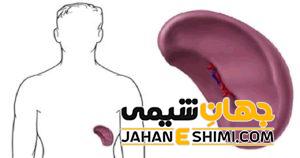 دلیل بزرگ شدن طحال چیست؟ | دارو و درمان بزرگ شدن طحال