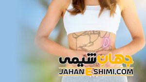 دلیل بزرگ شدن طحال چیست؟ | دارو و درمان بزرگ شدن طحال