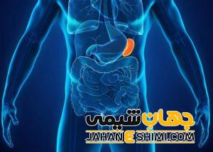 دلیل بزرگ شدن طحال چیست؟ | دارو و درمان بزرگ شدن طحال