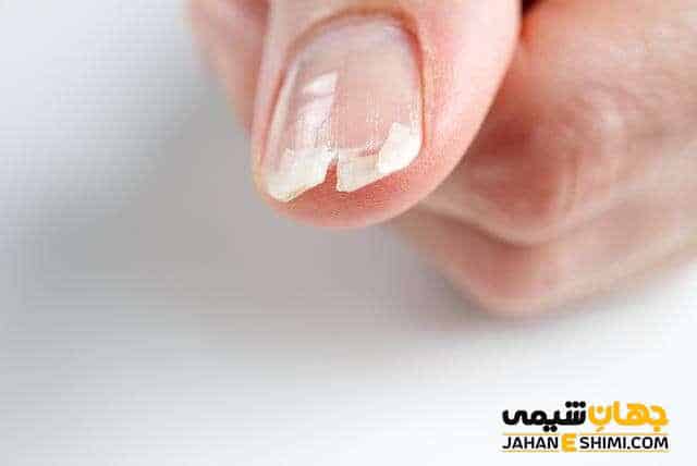 علت ترک خوردن ناخن | روش ترمیم خانگی ترک خوردن ناخن