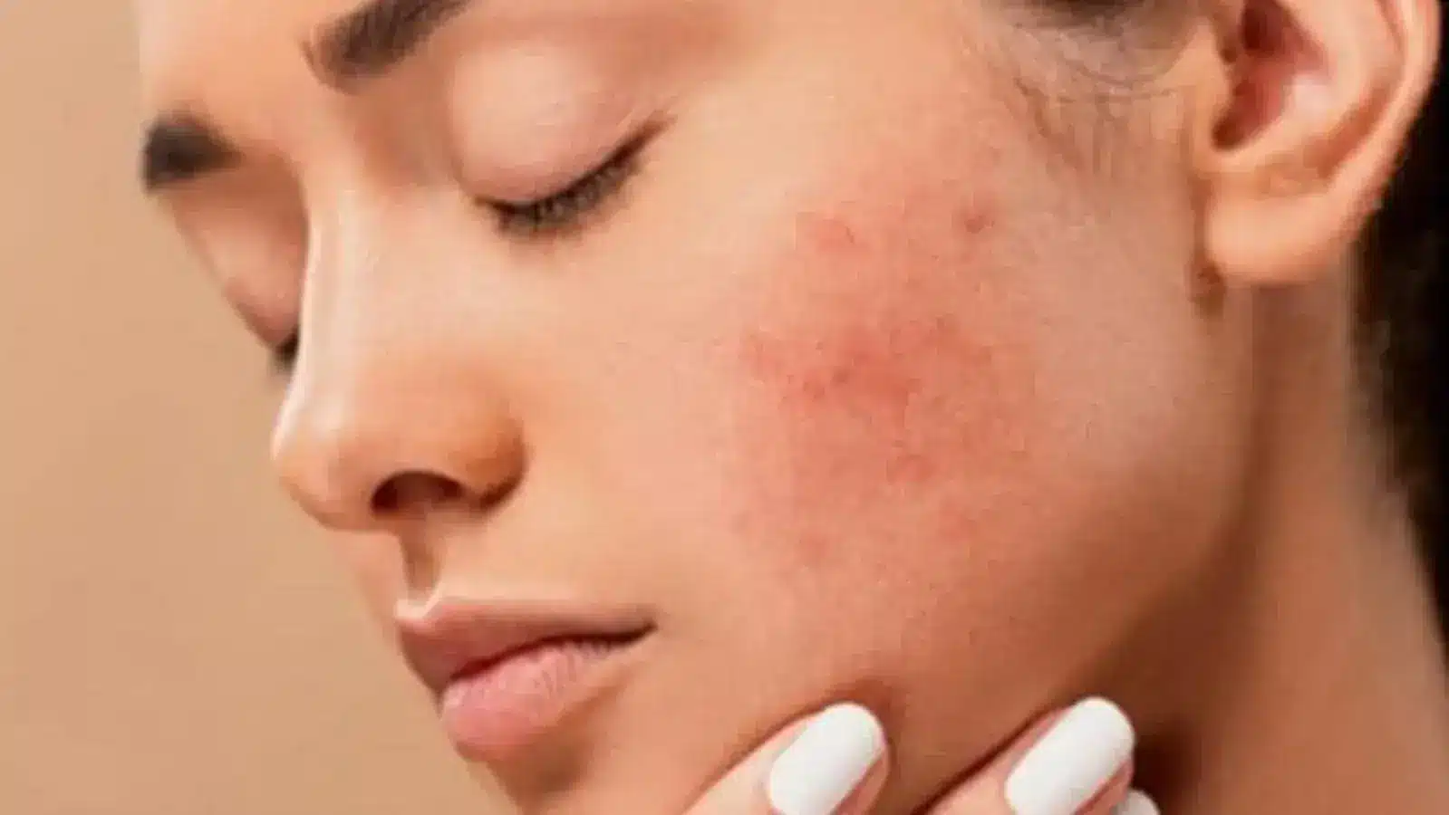 عمل تغییر رنگ پوست به سفید
