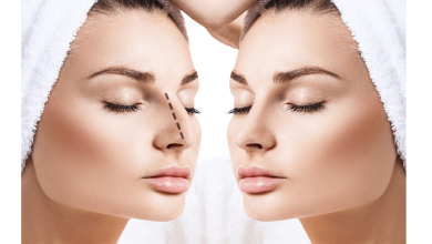 چسب لیفت بینی چیست؟