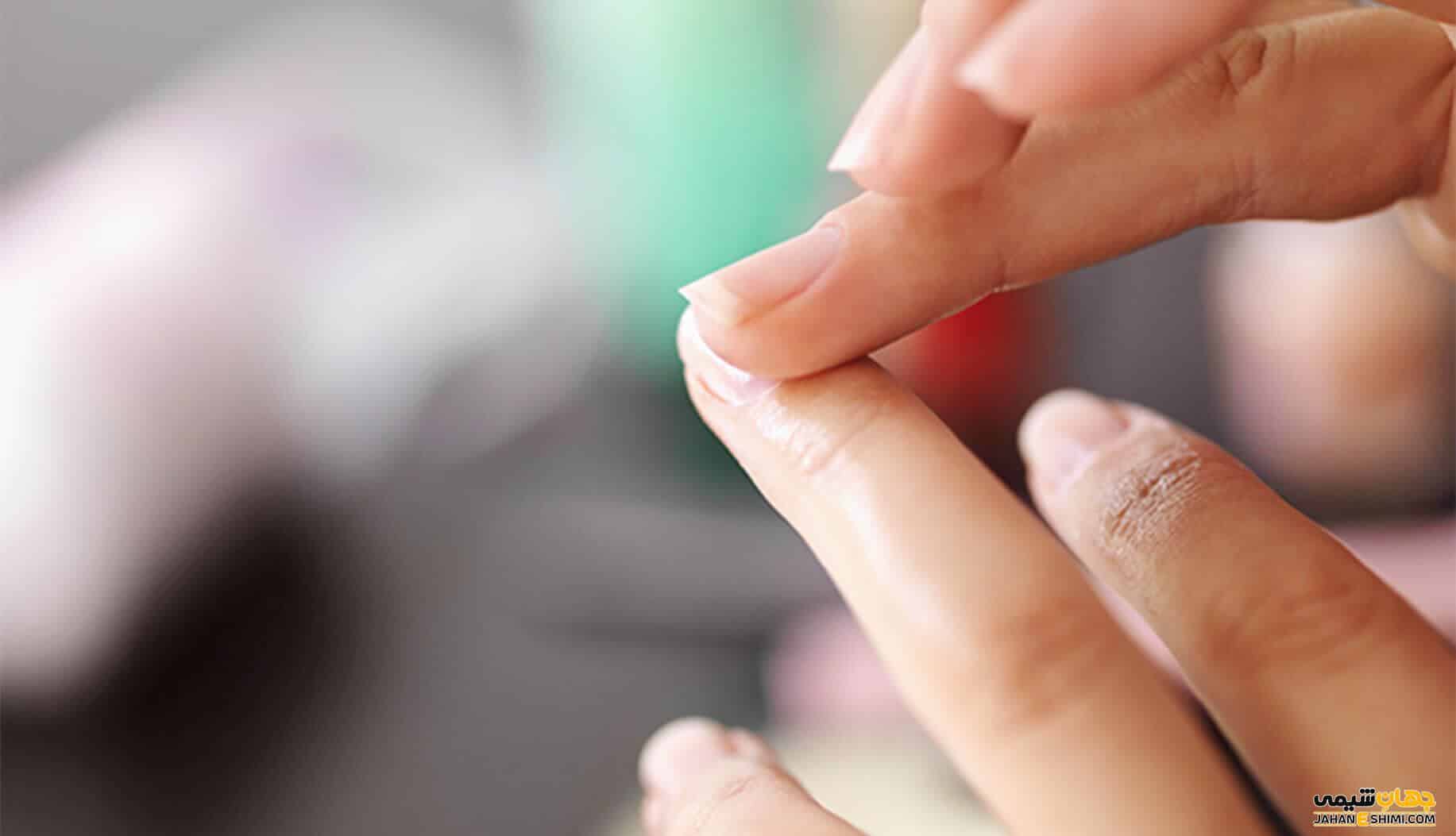 چگونه از ترک خوردن ناخن جلوگیری کنیم