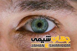 تغییر رنگ چشم چگونه امکان پذیر است؟