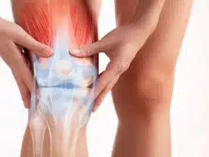 گرمی مفصل چیست؟ | دارو و درمان گرمی مفصل