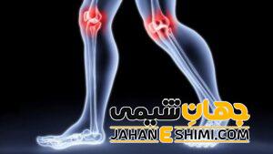 گرمی مفصل چیست؟ | دارو و درمان گرمی مفصل