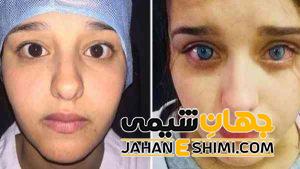 تغییر رنگ چشم چگونه امکان پذیر است؟