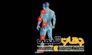 گرمی مفصل چیست؟ | دارو و درمان گرمی مفصل