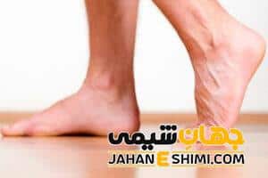 علت لنگیدن پا چیست؟ | دارو و درمان لنگیدن پا