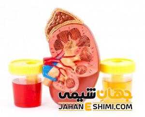 ادرار قرمز به چه دلیل رخ می دهد؟ | دارو و درمان ادرار قرمز