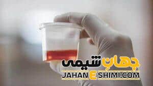 ادرار قرمز به چه دلیل رخ می دهد؟ | دارو و درمان ادرار قرمز