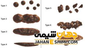 مدفوع چرب نشانه چیست؟ | دارو و درمان مدفوع چرب