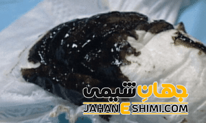 مدفوع سیاه و تیره نشانه چیست؟ | دارو درمان مدفوع سیاه و تیره