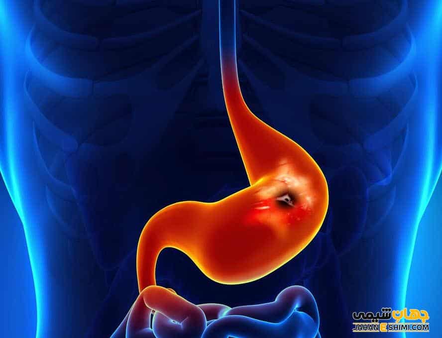 مدفوع سیاه و تیره نشانه چیست؟ | دارو درمان مدفوع سیاه و تیره