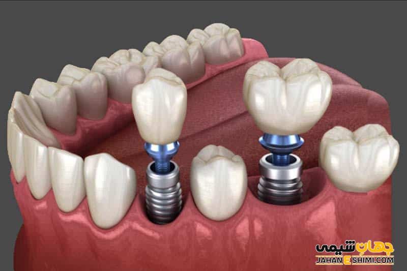 کلینیک دندانپزشکی آیریک